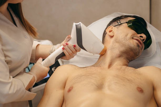 Can Men’s Laser Hair Removal Treat Neck Hair Growth