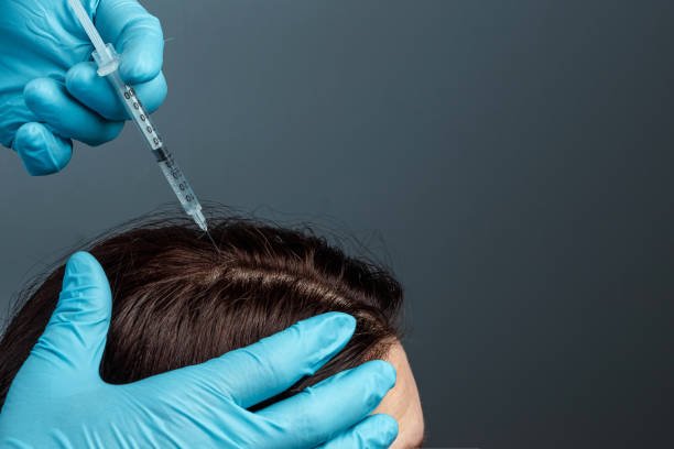 Can PRP Hair Treatment support healthier follicles