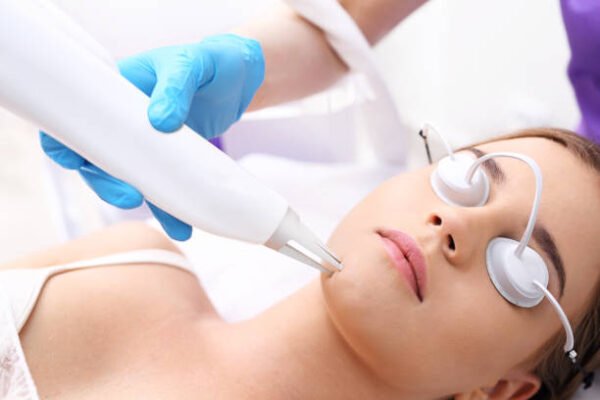 Can Pico Laser Treatment Help With Age Spots on Skin