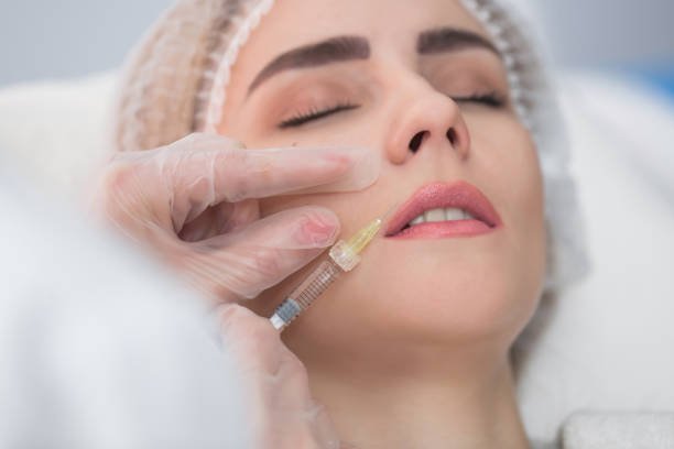 Can Russian Lip Fillers Enhance Thin Upper Lips