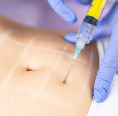 Discover a Personalized Contouring Experience with Fat-Dissolving Injections