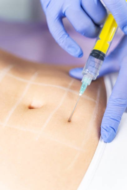 Discover a Personalized Contouring Experience with Fat-Dissolving Injections