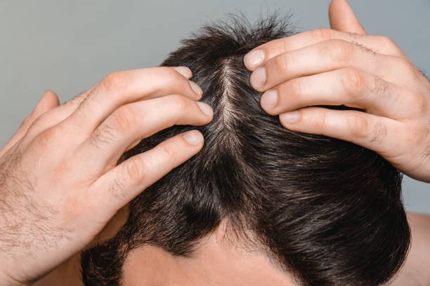 Does GFC Treatment for Hair offer lasting improvements