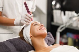 Does Microneedling Improve Post-Acne Skin Texture