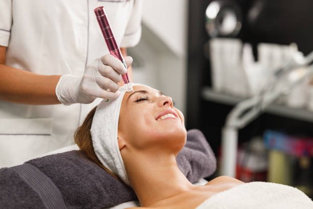 Does Microneedling Improve Post-Acne Skin Texture