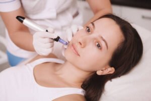 Does RF Microneedling Provide Gradual Skin Tightening