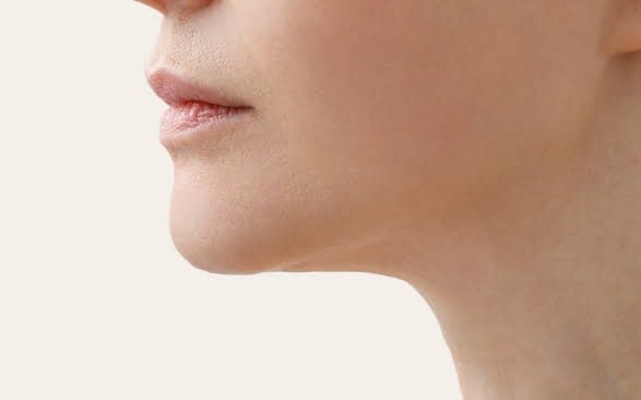 Double Chin Removal in Islamabad