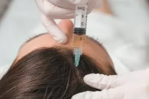 Enhance Your Hair Care Routine with Hair Loss Treatments