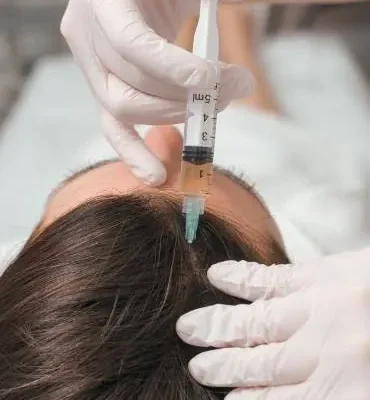 Enhance Your Hair Care Routine with Hair Loss Treatments