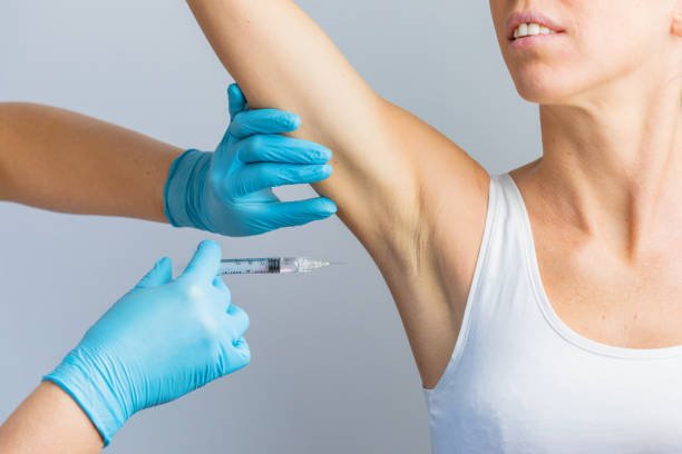 How Do Botox Injections for Sweaty Glands Support Sweat Control