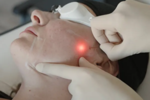 EndoLift Abu Dhabi