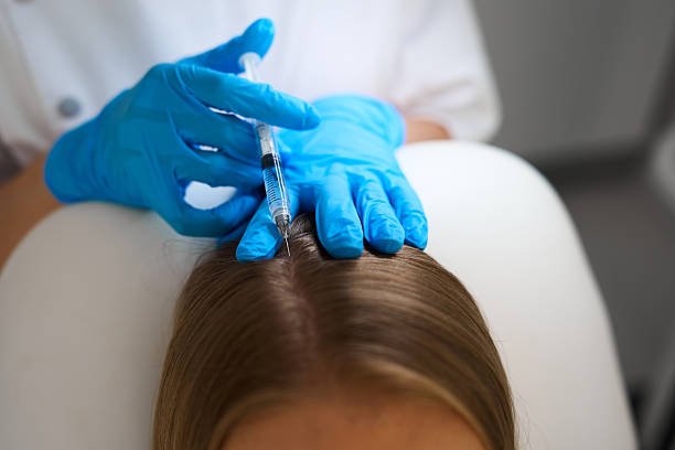 How Does PRP Hair Treatment Target Hair Loss