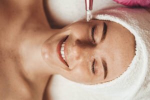 Is Fractional RF Micro Needling Suitable for Oily Skin