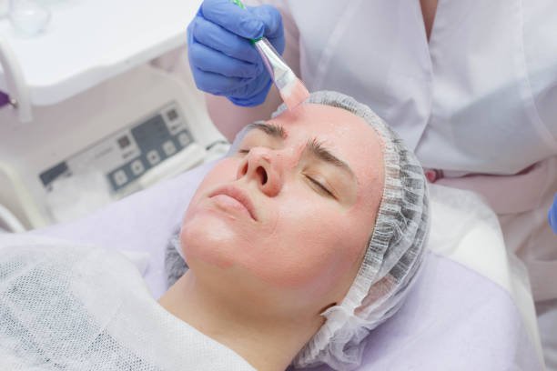 Is Inno Peel Treatment Safe for Acne Scar Reduction