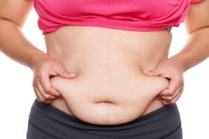 Mini Abdominoplasty in Abu Dhabi