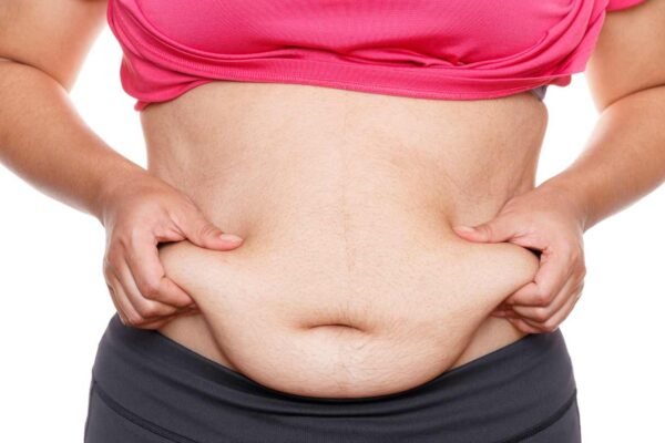Mini Abdominoplasty in Abu Dhabi