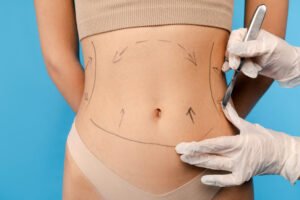 Tummy Tuck Abu Dhabi