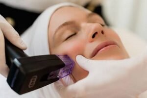 Morpheus8 Treatment in Muscat