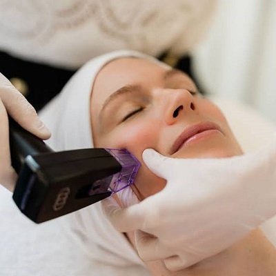 Morpheus8 Treatment in Muscat