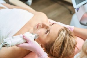 What Is the Best Age to Start CO2 Laser Treatment
