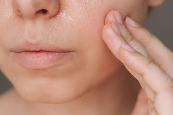 Large Pores Treatment in Abu Dhabi