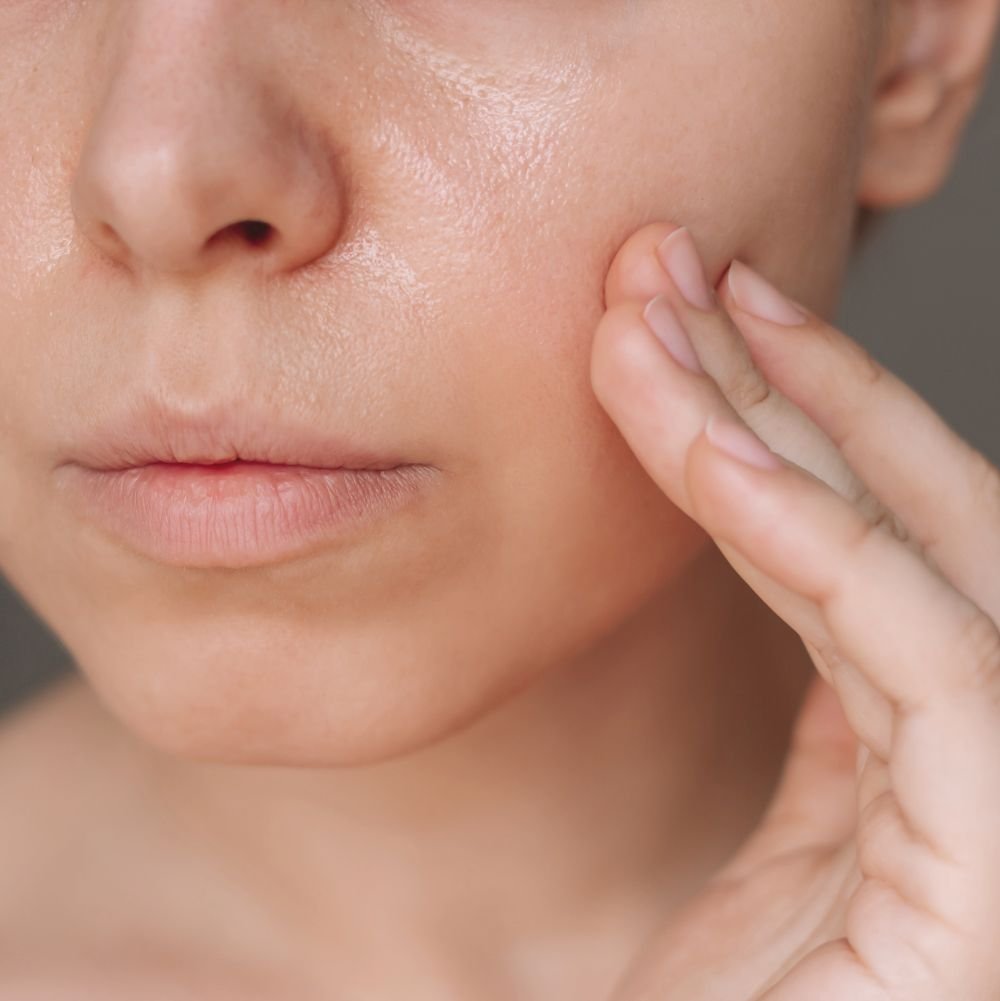 Large Pores Treatment in Abu Dhabi