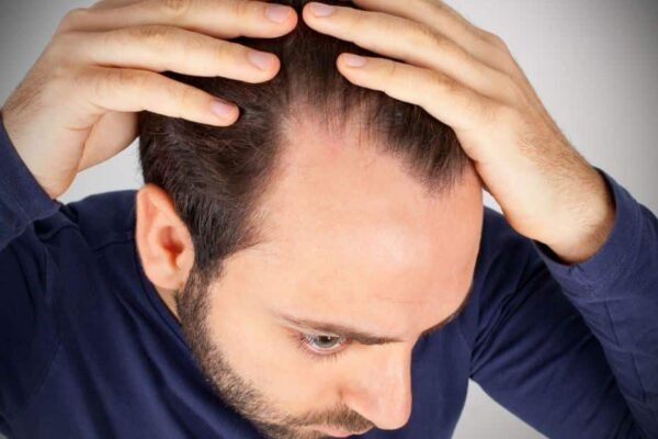 Scalp Micropigmentation Abu Dhabi