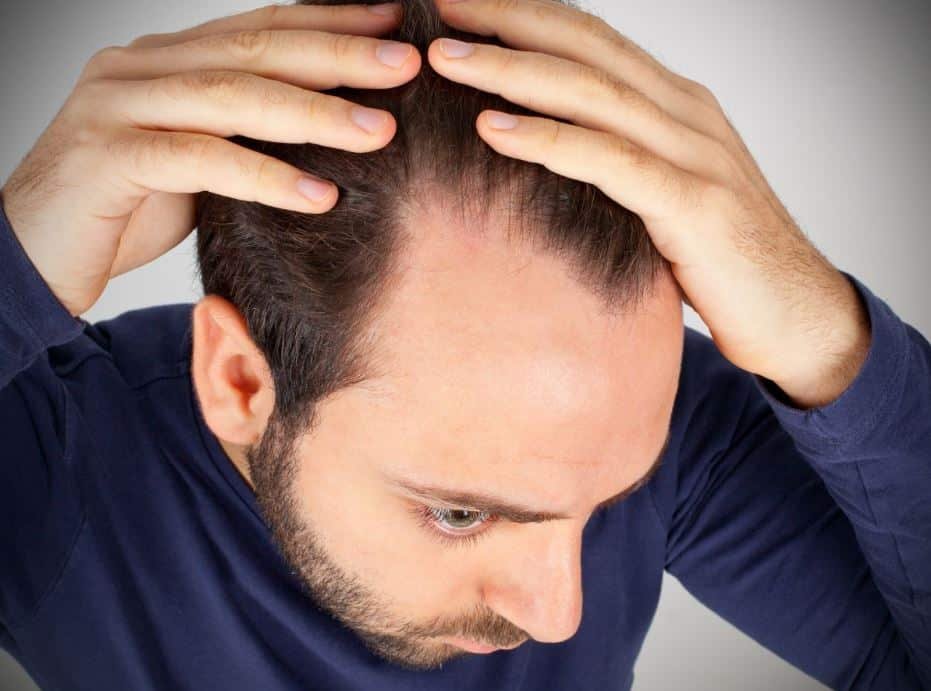Scalp Micropigmentation Abu Dhabi
