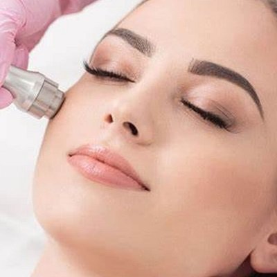 Microdermabrasion